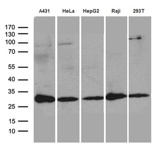 RANBP1 Antibody in Western Blot (WB)