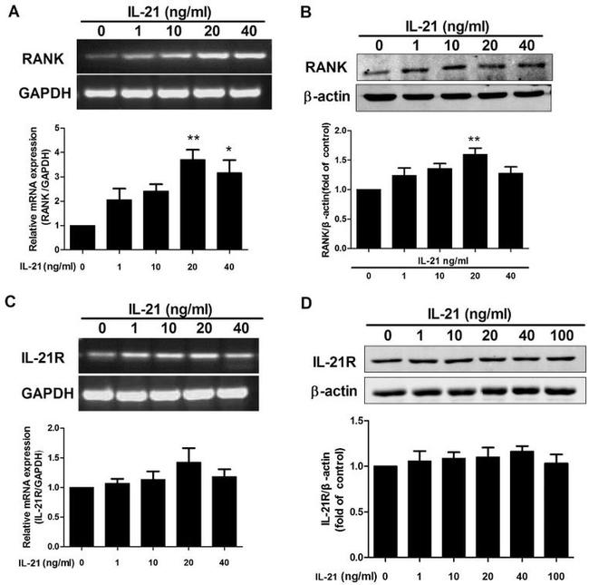 CD265 (RANK) Antibody in Western Blot (WB)