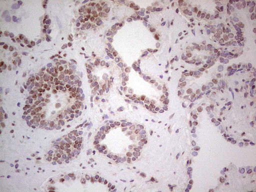 RARA Antibody in Immunohistochemistry (Paraffin) (IHC (P))