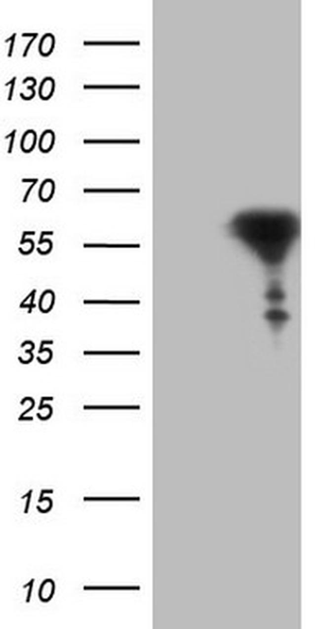 RARA Antibody in Western Blot (WB)