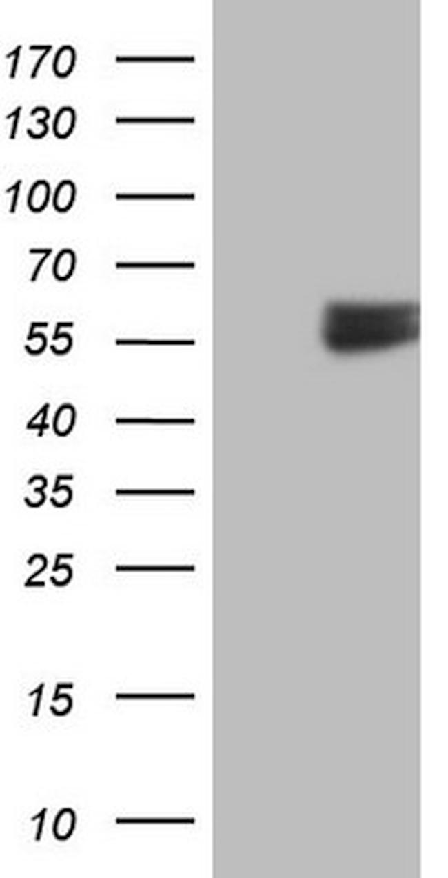 RARA Antibody in Western Blot (WB)