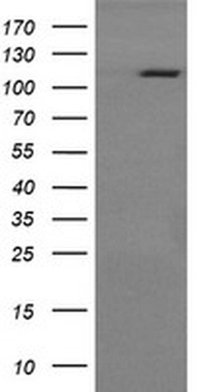 RASA1 Antibody in Western Blot (WB)
