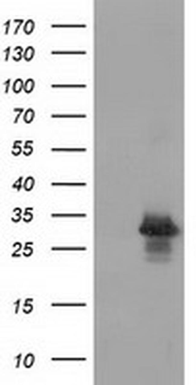 RASD2 Antibody in Western Blot (WB)