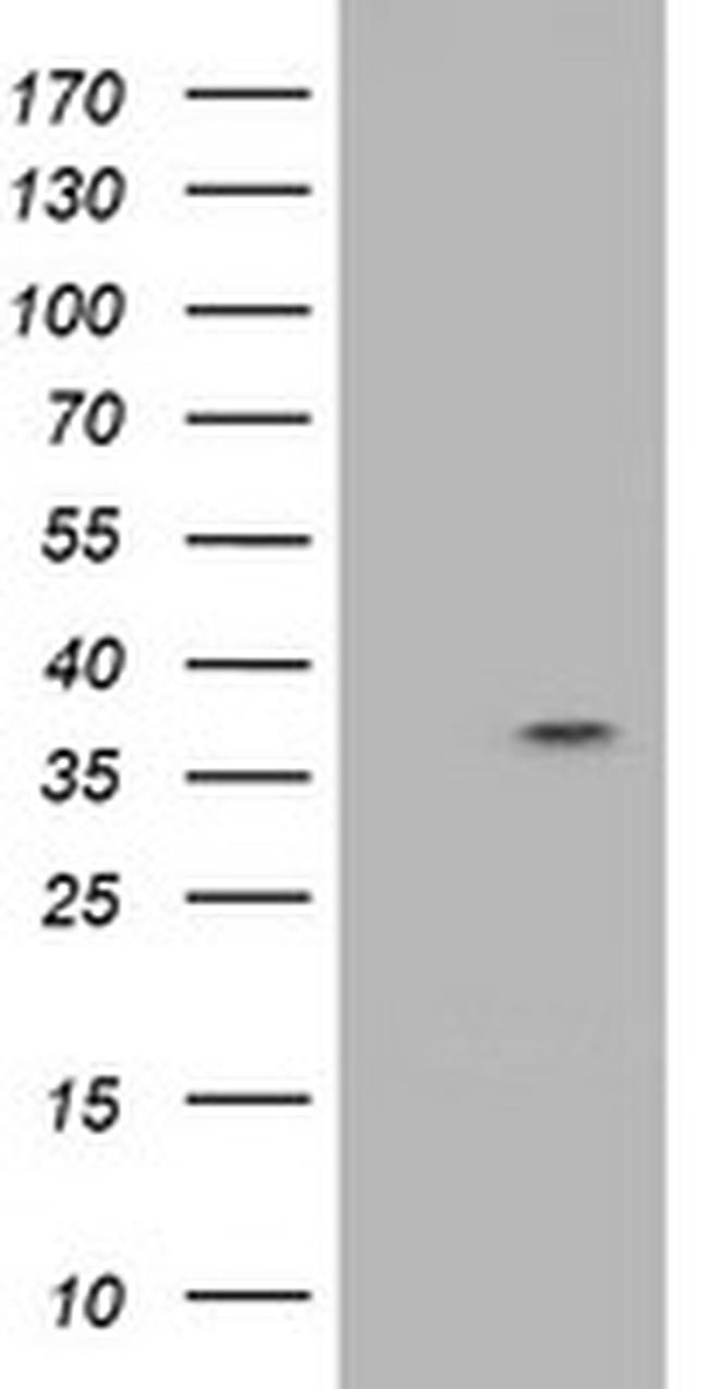 RASSF1 Antibody in Western Blot (WB)