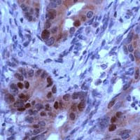 Rb Antibody in Immunohistochemistry (IHC)