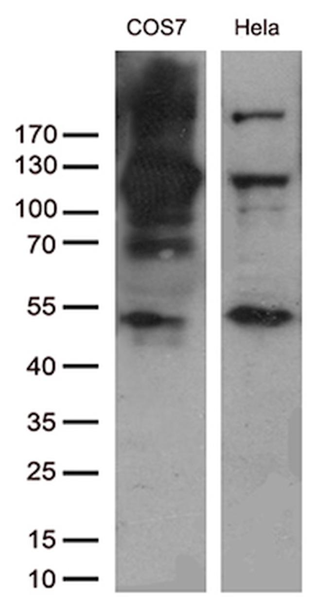 RB1 Antibody in Western Blot (WB)