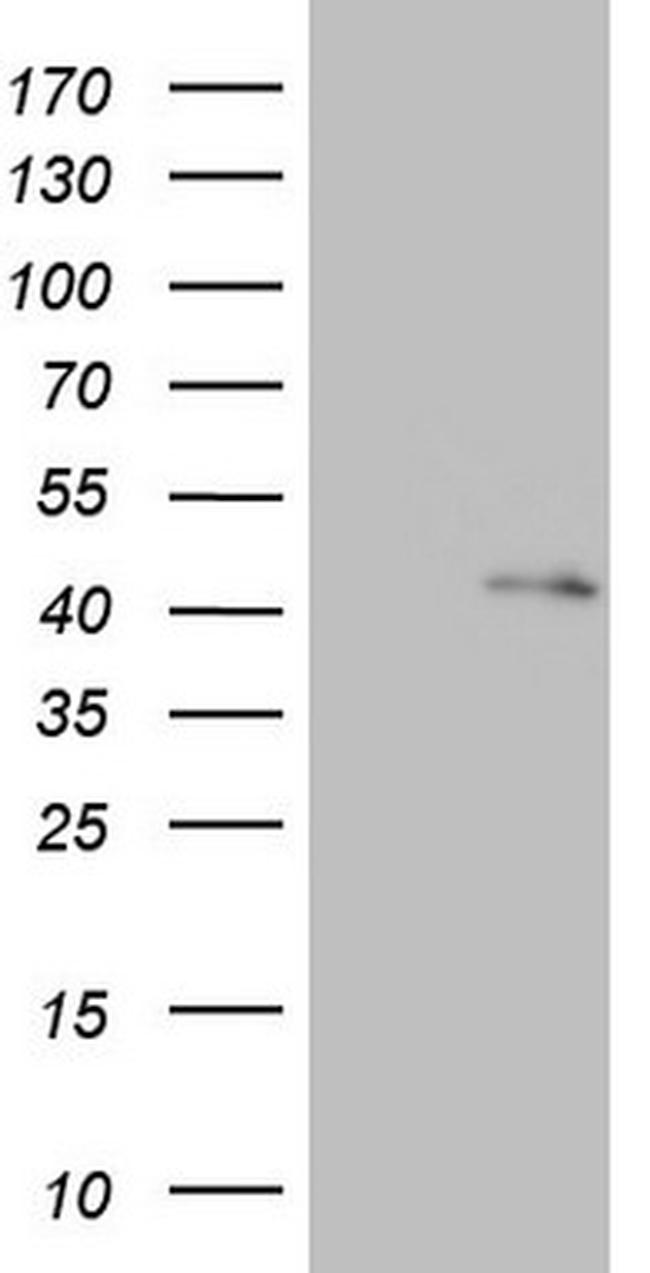 RBFOX1 Antibody in Western Blot (WB)