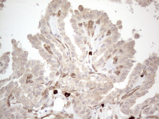 RBMS1 Antibody in Immunohistochemistry (Paraffin) (IHC (P))