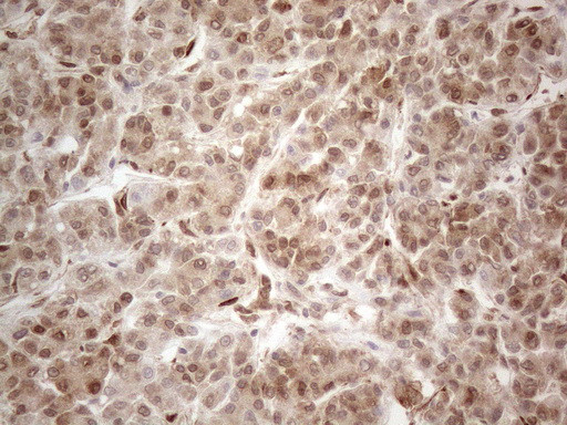 RBMS1 Antibody in Immunohistochemistry (Paraffin) (IHC (P))