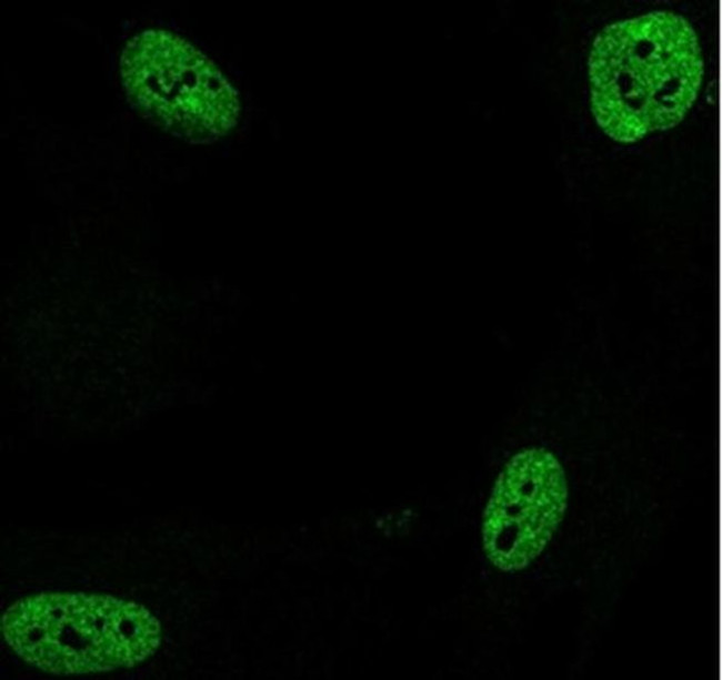 RBMX Antibody in Immunocytochemistry (ICC/IF)