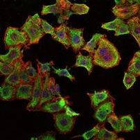 RBP4 Antibody in Immunocytochemistry (ICC/IF)