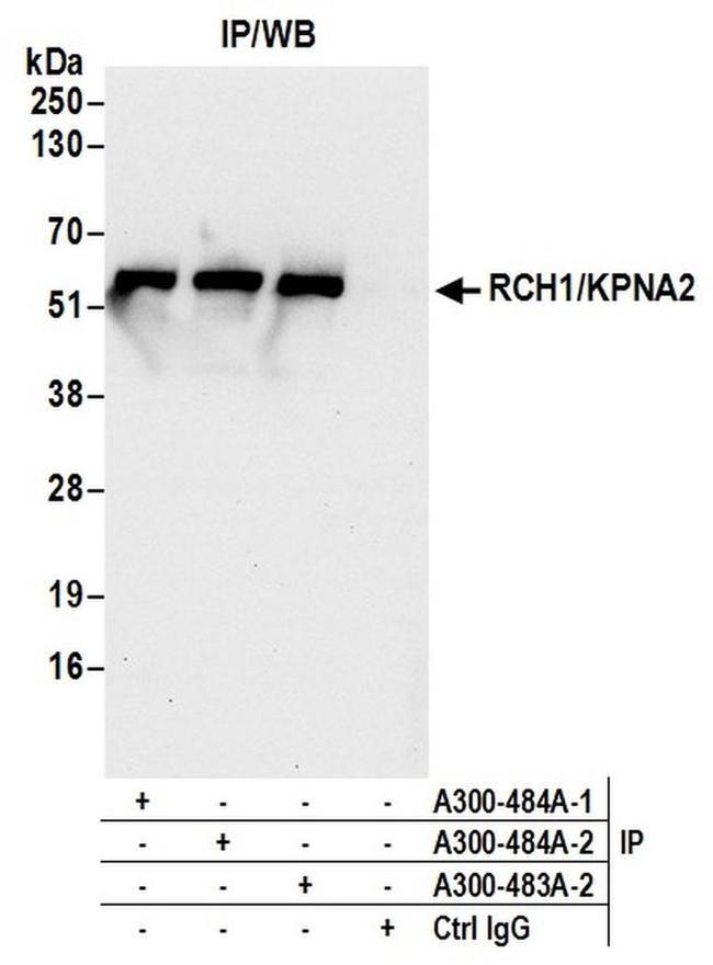 RCH1/KPNA2 Antibody in Western Blot (WB)