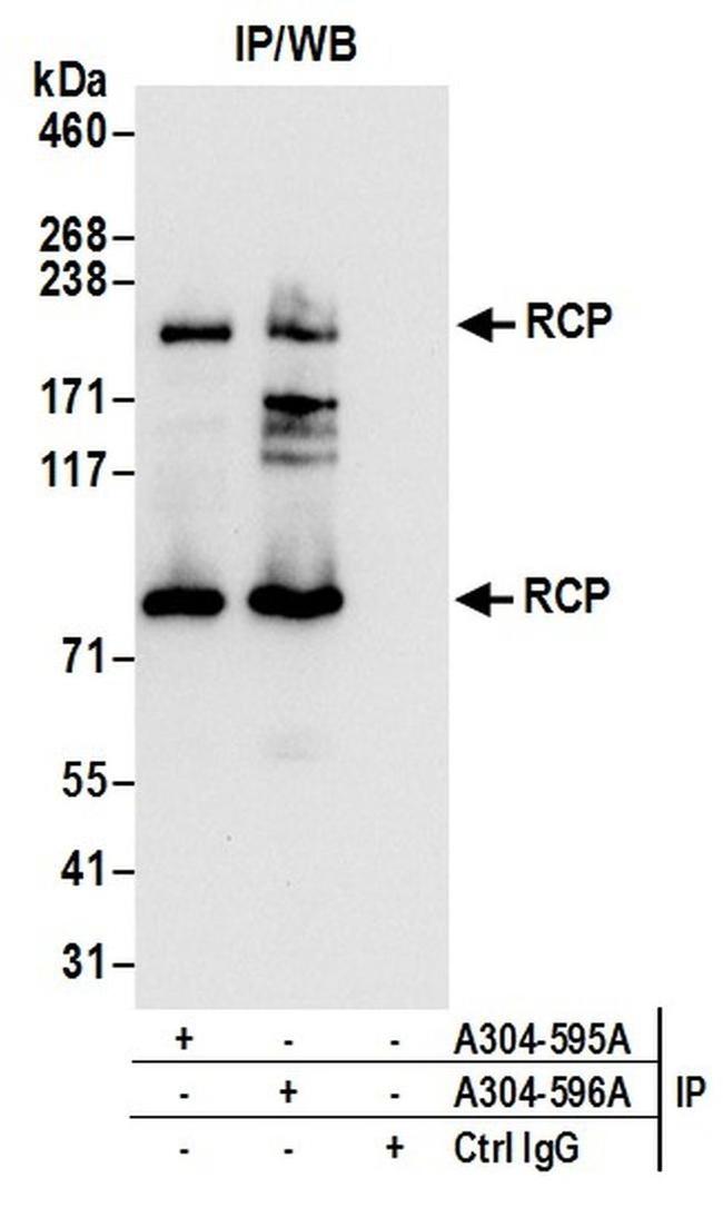 RCP Antibody in Western Blot (WB)