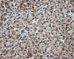 RDH11 Antibody in Immunohistochemistry (Paraffin) (IHC (P))