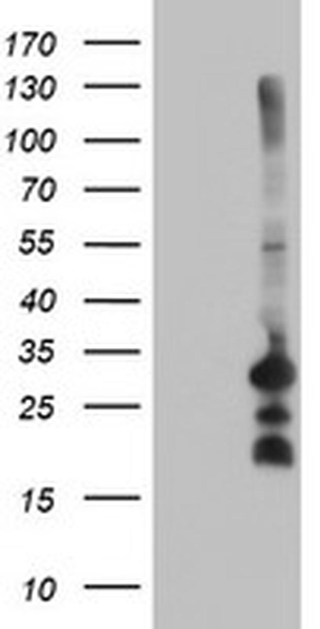 REEP2 Antibody in Western Blot (WB)