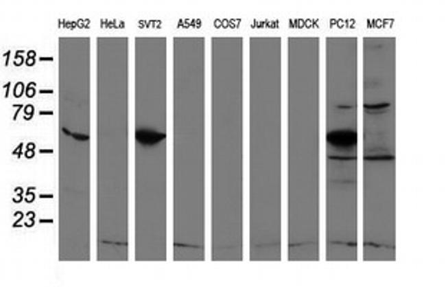 REEP2 Antibody in Western Blot (WB)