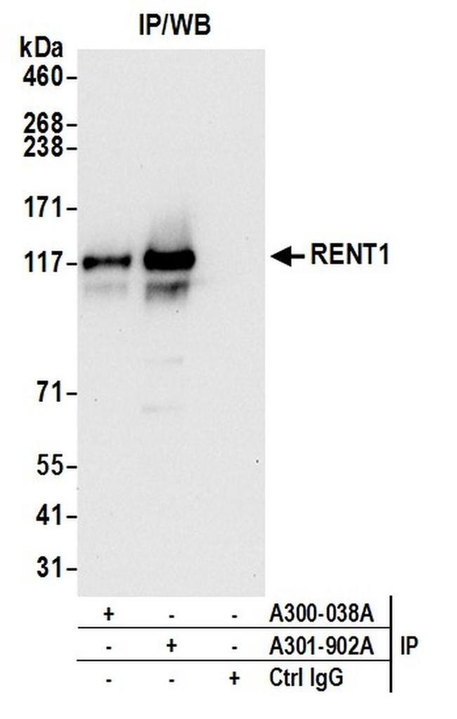 RENT1 Antibody in Western Blot (WB)