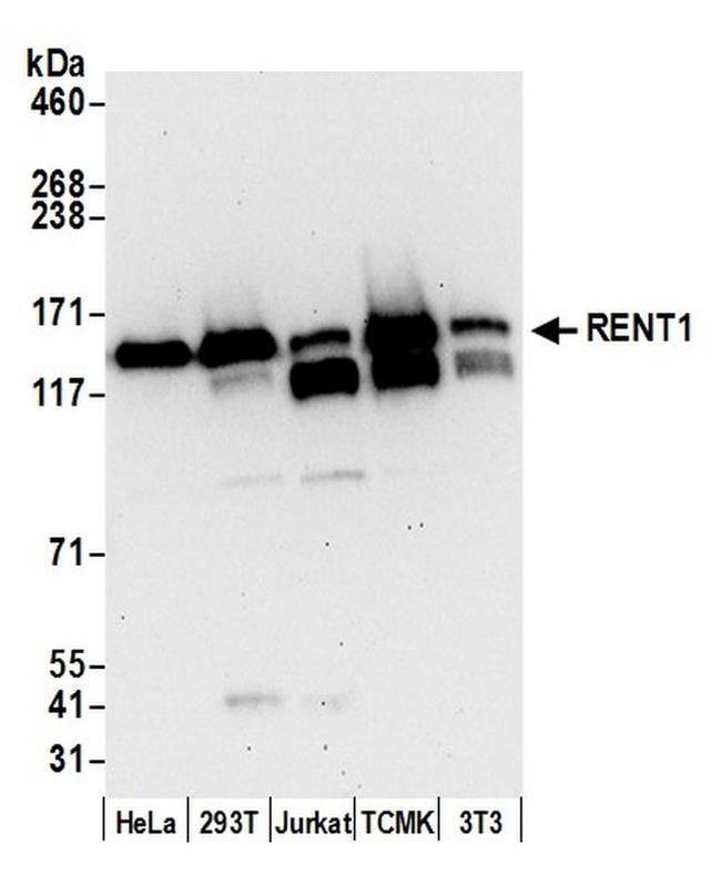 RENT1 Antibody in Western Blot (WB)