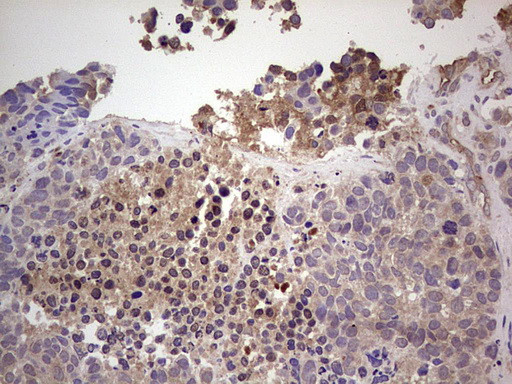 RET Antibody in Immunohistochemistry (Paraffin) (IHC (P))