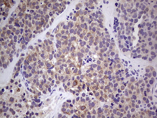 RET Antibody in Immunohistochemistry (Paraffin) (IHC (P))