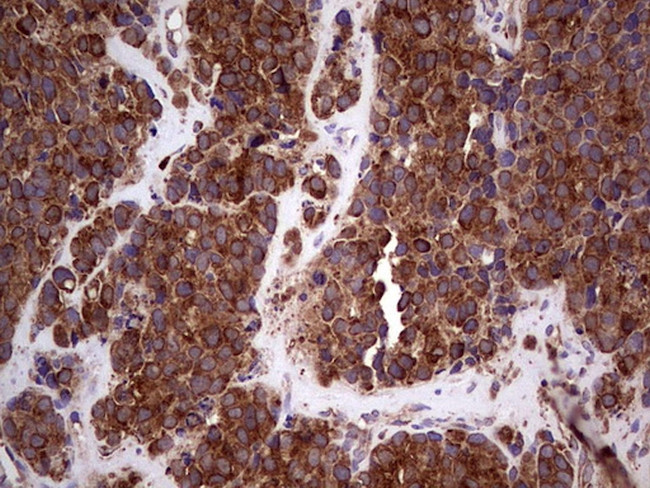 RET Antibody in Immunohistochemistry (Paraffin) (IHC (P))