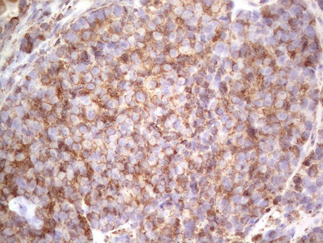 RET Antibody in Immunohistochemistry (Paraffin) (IHC (P))