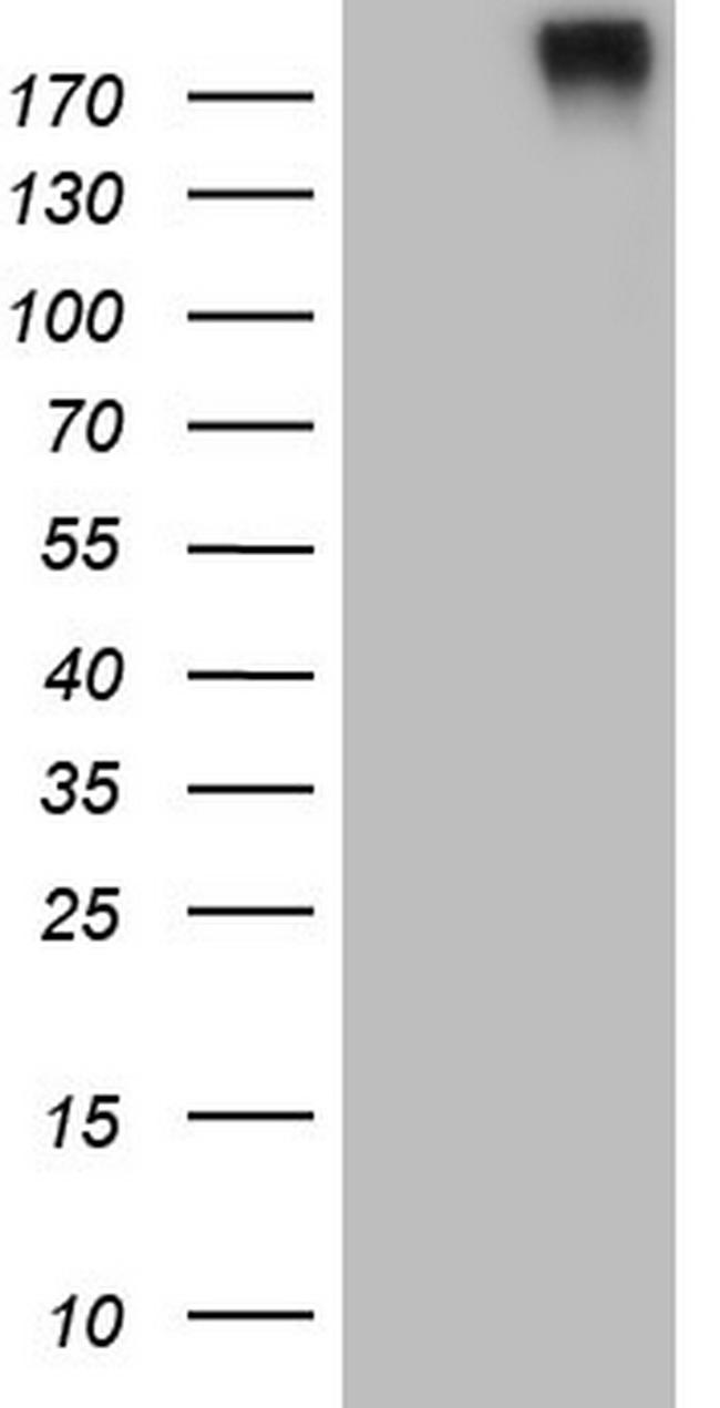 RET Antibody in Western Blot (WB)