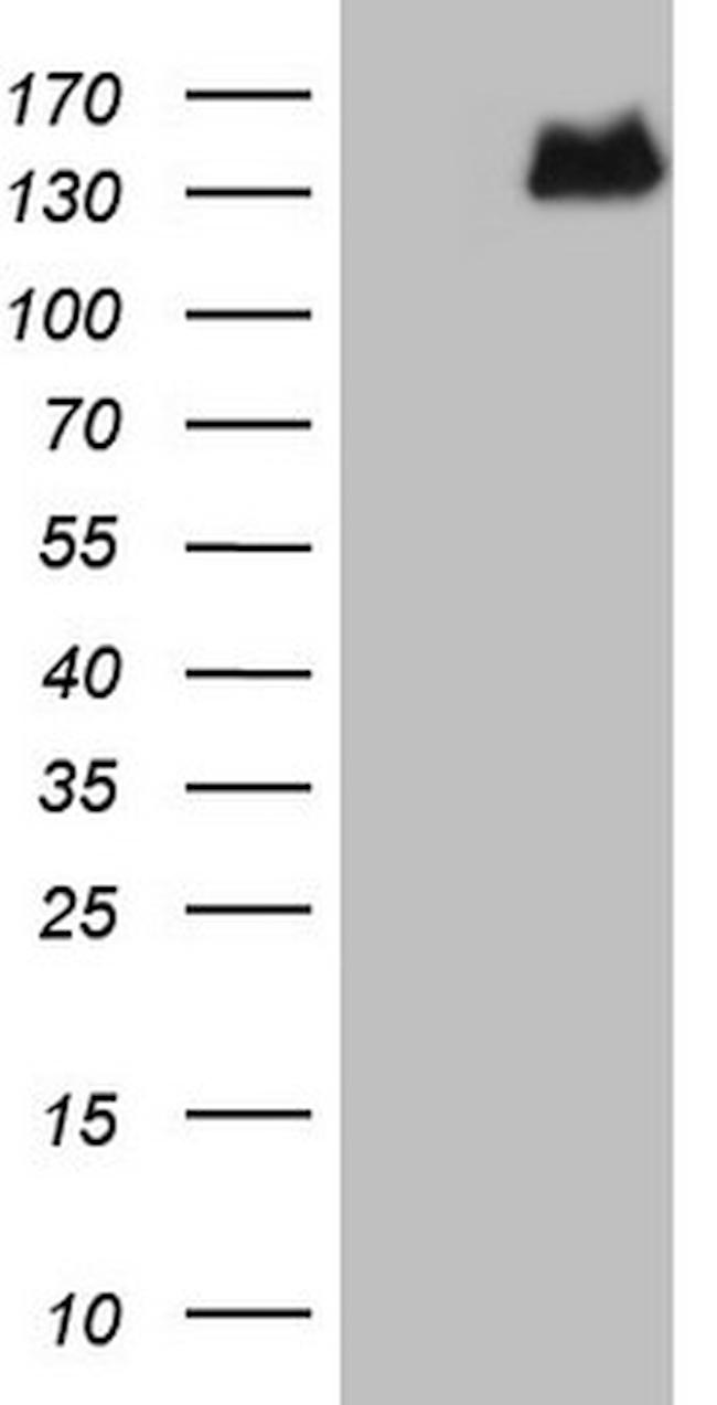 RET Antibody in Western Blot (WB)