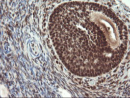 RFC2 Antibody in Immunohistochemistry (Paraffin) (IHC (P))