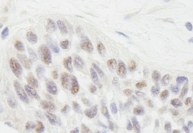 RIF1 Antibody in Immunohistochemistry (IHC)