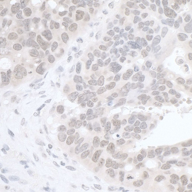 RIF1 Antibody in Immunohistochemistry (IHC)