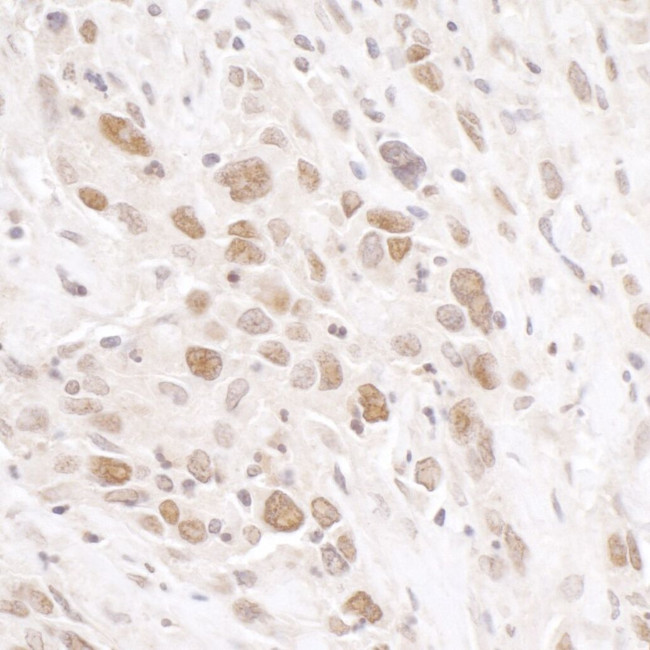 RIF1 Antibody in Immunohistochemistry (IHC)