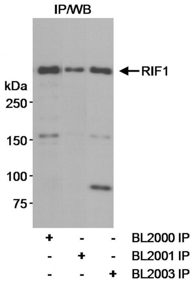 RIF1 Antibody in Immunoprecipitation (IP)