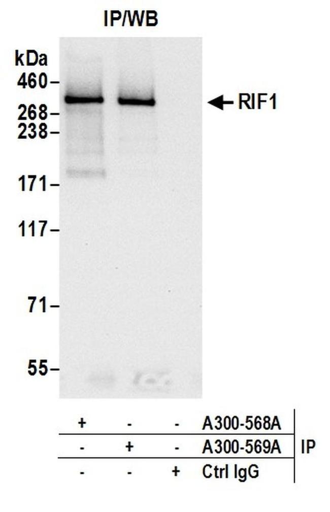 RIF1 Antibody in Western Blot (WB)