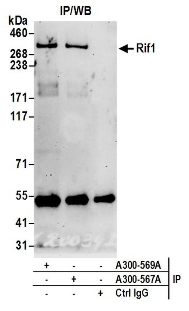 RIF1 Antibody in Western Blot (WB)