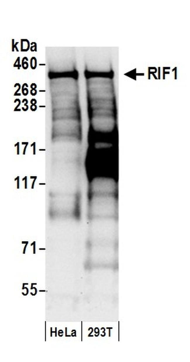 RIF1 Antibody in Western Blot (WB)