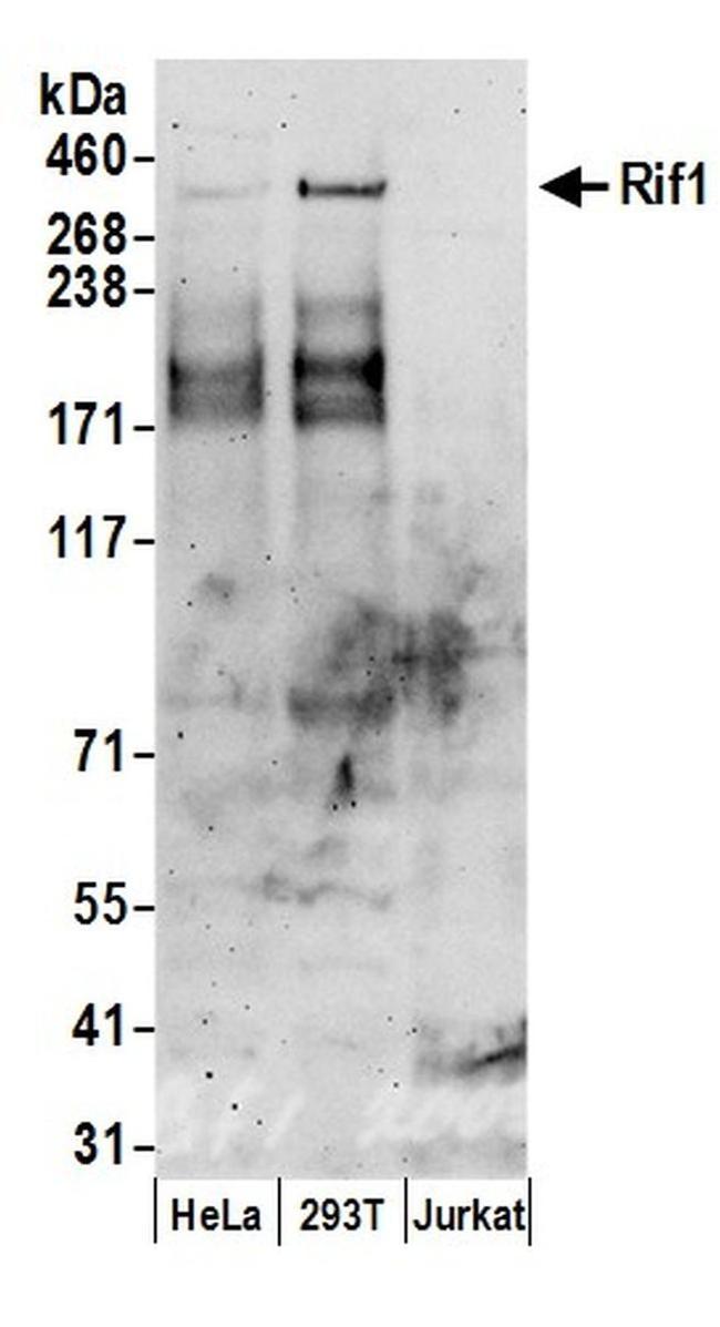 RIF1 Antibody in Western Blot (WB)