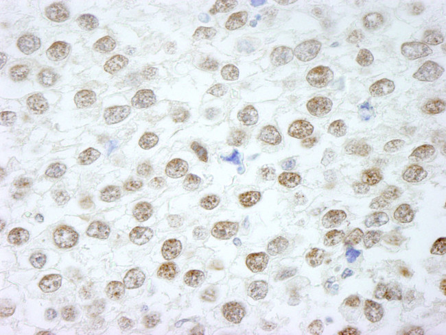 RIF1 Antibody in Immunohistochemistry (IHC)