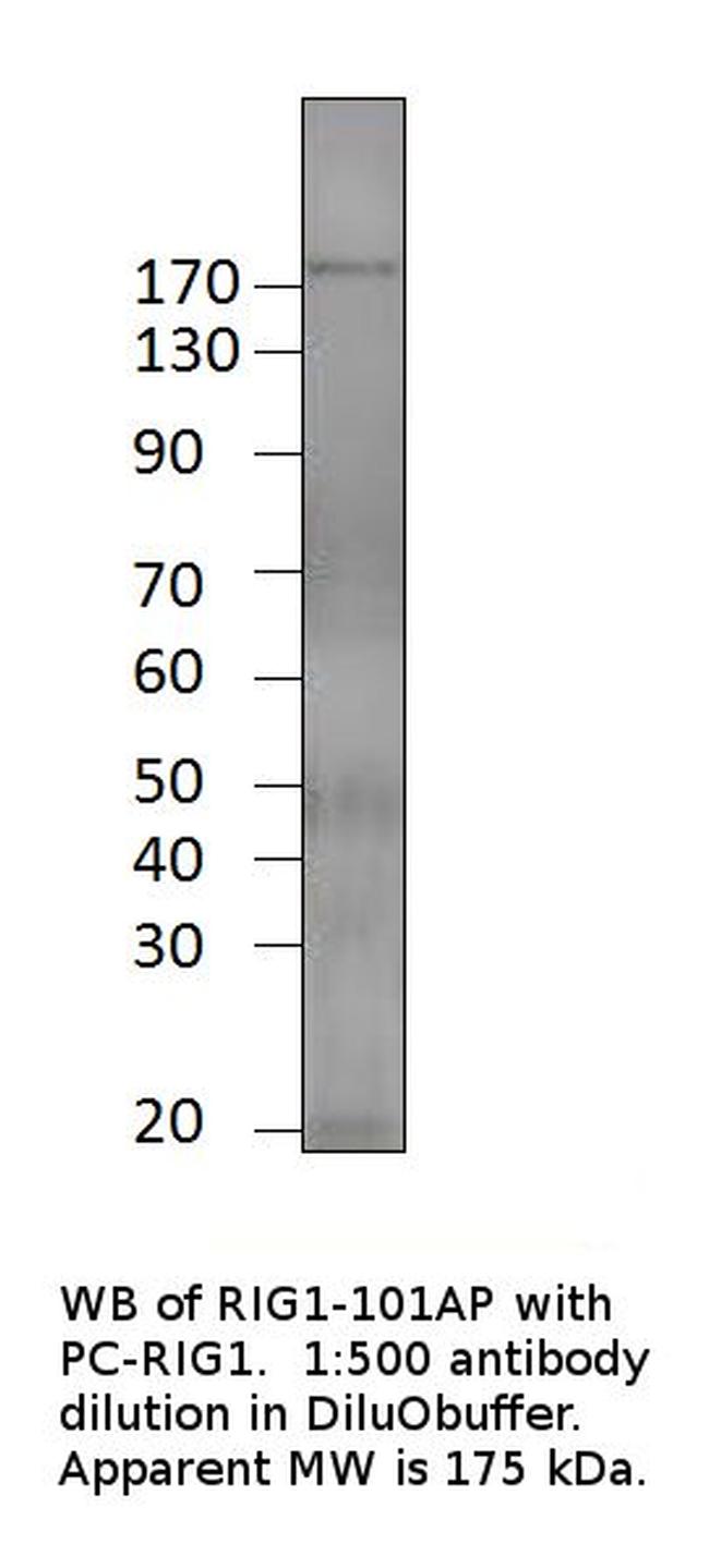 Robo3 Antibody in Western Blot (WB)