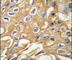 RIP3 Antibody in Immunohistochemistry (IHC)