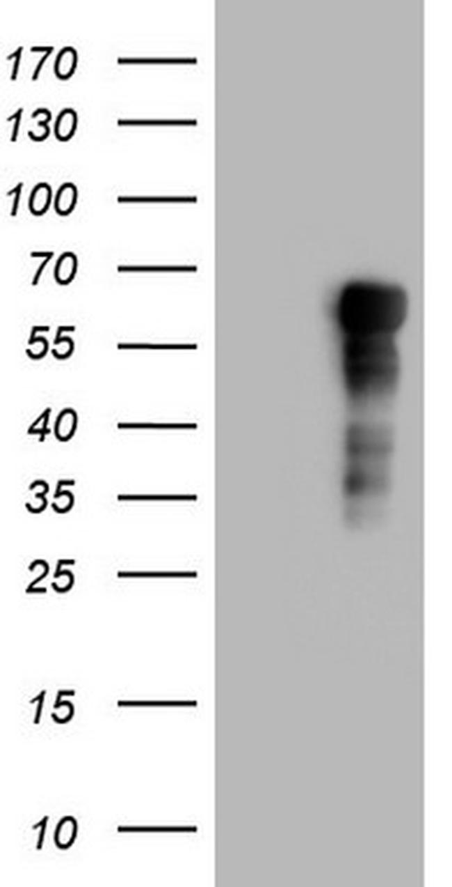 RIPK3 Antibody in Western Blot (WB)