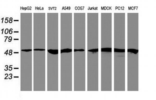 RNF113B Antibody in Western Blot (WB)