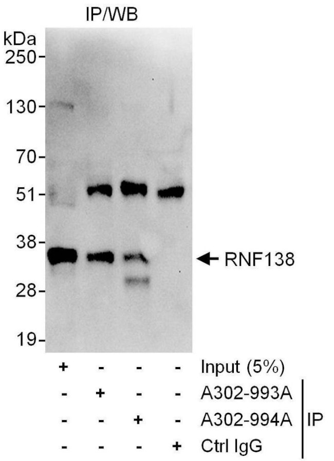 RNF138 Antibody in Immunoprecipitation (IP)