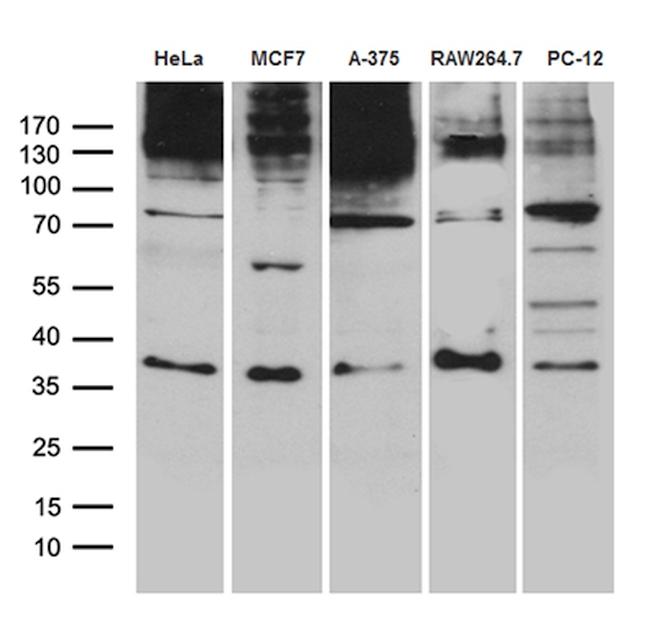 RNF4 Antibody in Western Blot (WB)