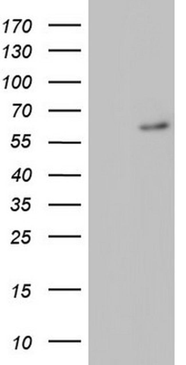 RORA Antibody in Western Blot (WB)