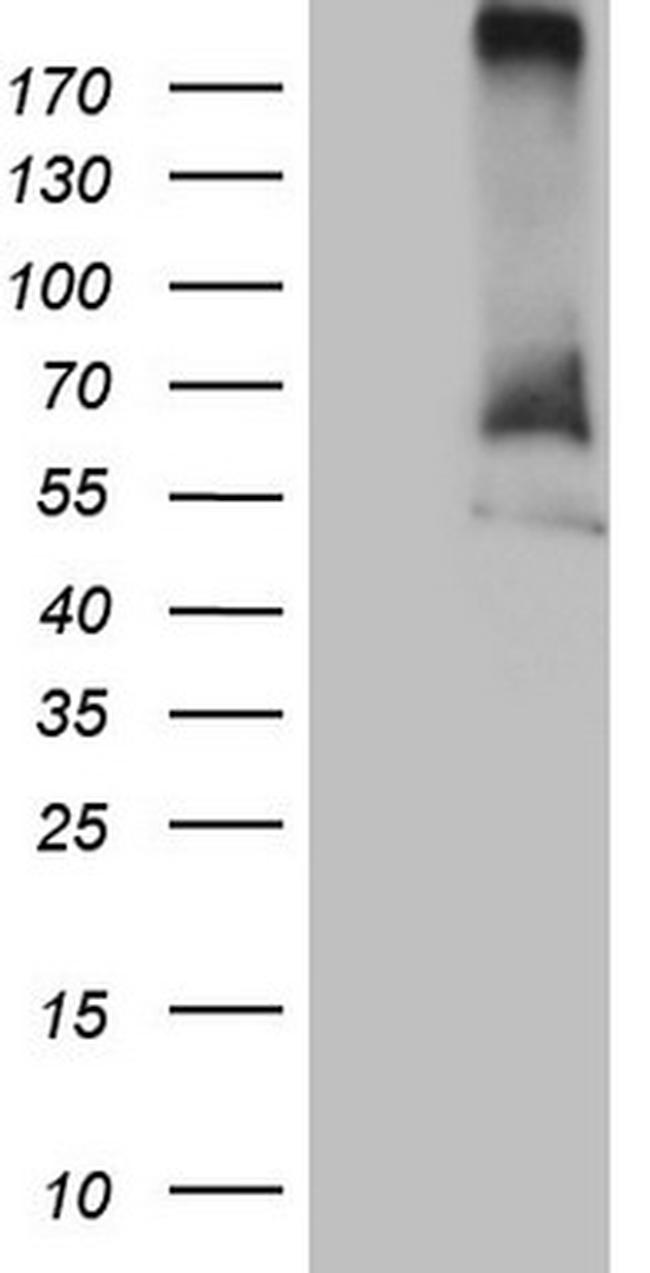 RORC Antibody in Western Blot (WB)