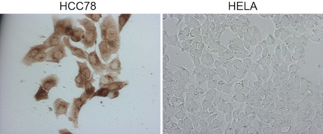 ROS1 Antibody in Immunocytochemistry (ICC/IF)