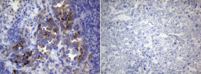 ROS1 Antibody in Immunohistochemistry (Paraffin) (IHC (P))