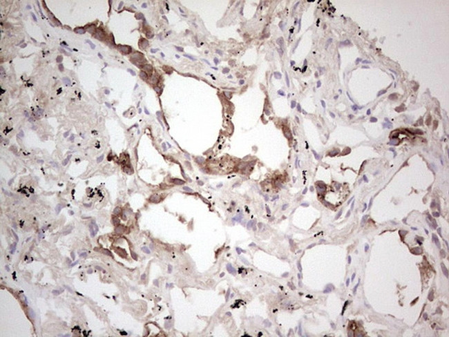 ROS1 Antibody in Immunohistochemistry (Paraffin) (IHC (P))