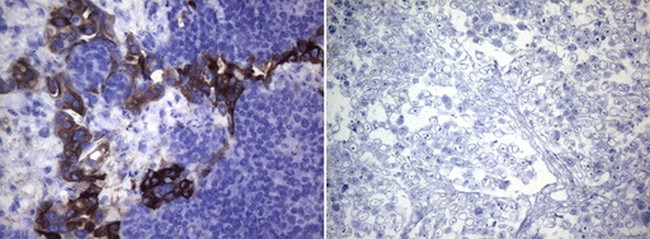 ROS1 Antibody in Immunohistochemistry (Paraffin) (IHC (P))